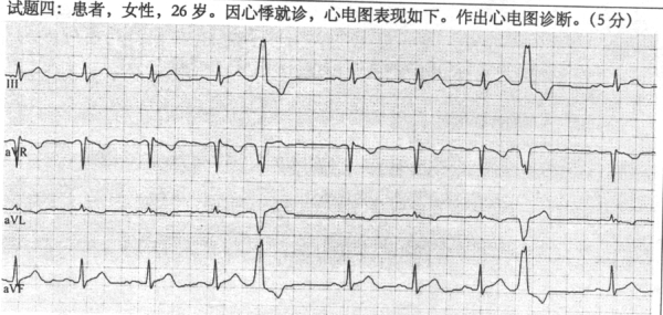 2018年中醫(yī)執(zhí)業(yè)助理醫(yī)師技能操作第三站試題